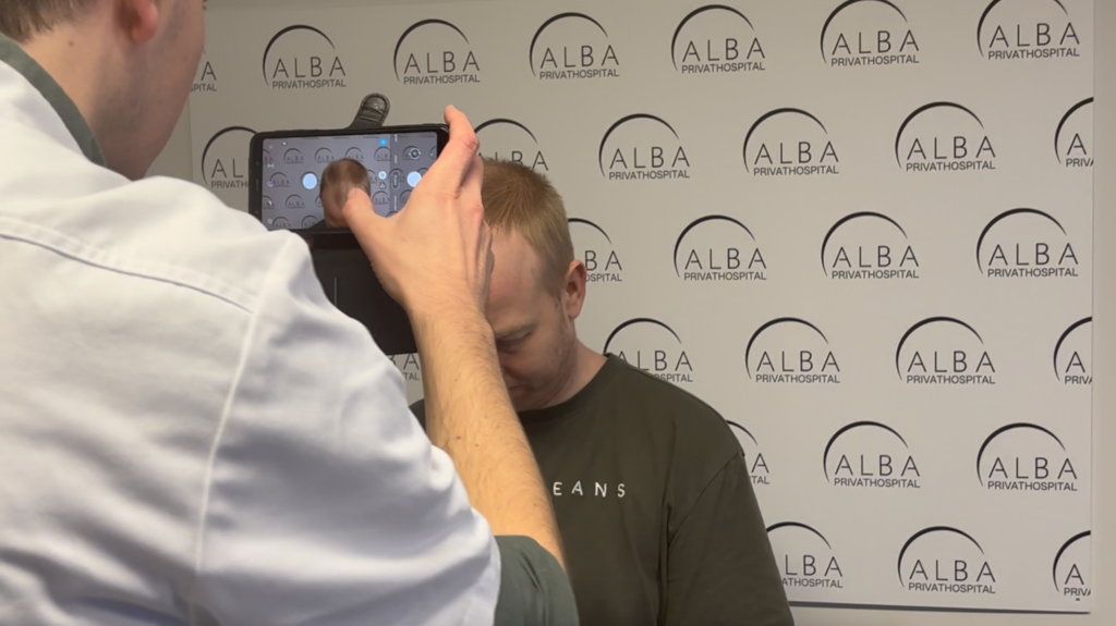 Mand får konsultation ved en specialist i hårtransplantation på Alba Privathospital.
